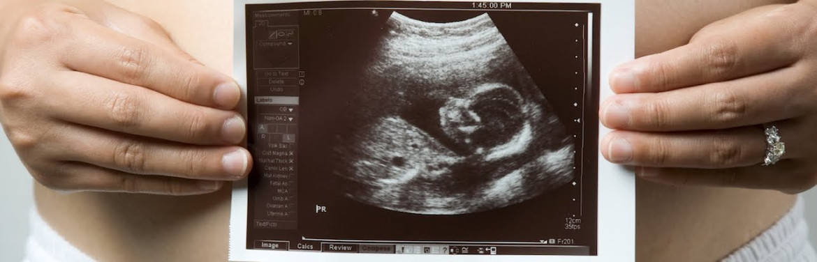 Ultrasound | Island Health