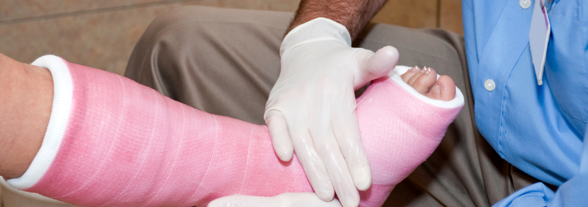 care provider holding a casted leg